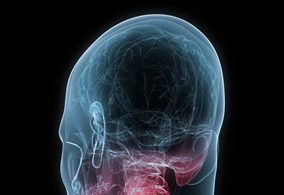 neurological conditions